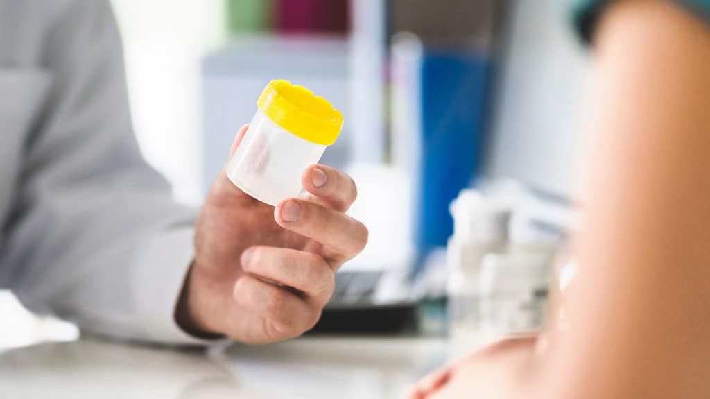 Czy CBD może sprawić, że nie przejdziesz testu narkotykowego?