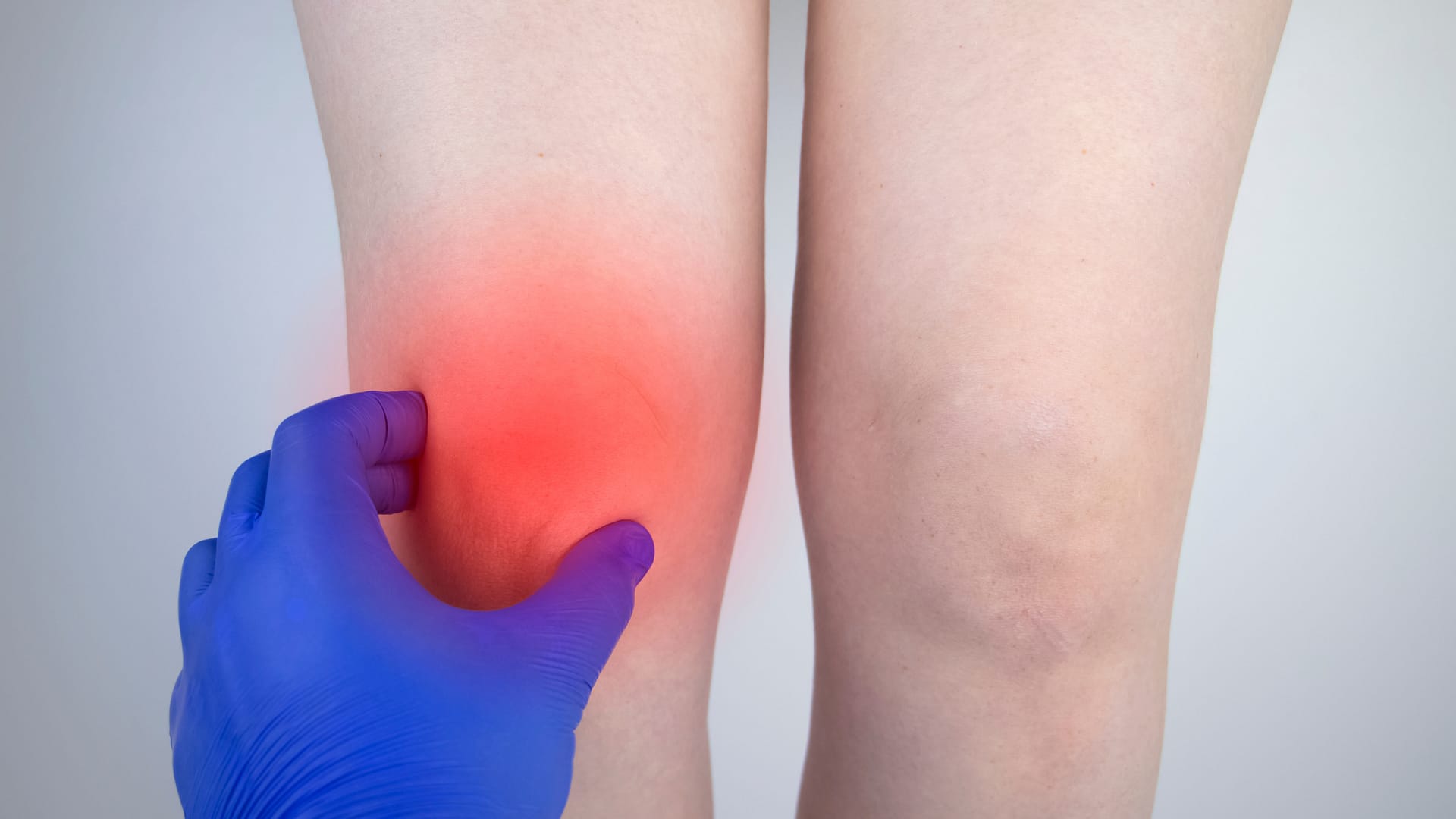 Olej CBD a uśmierzanie bólu w przypadku zapalenia stawów