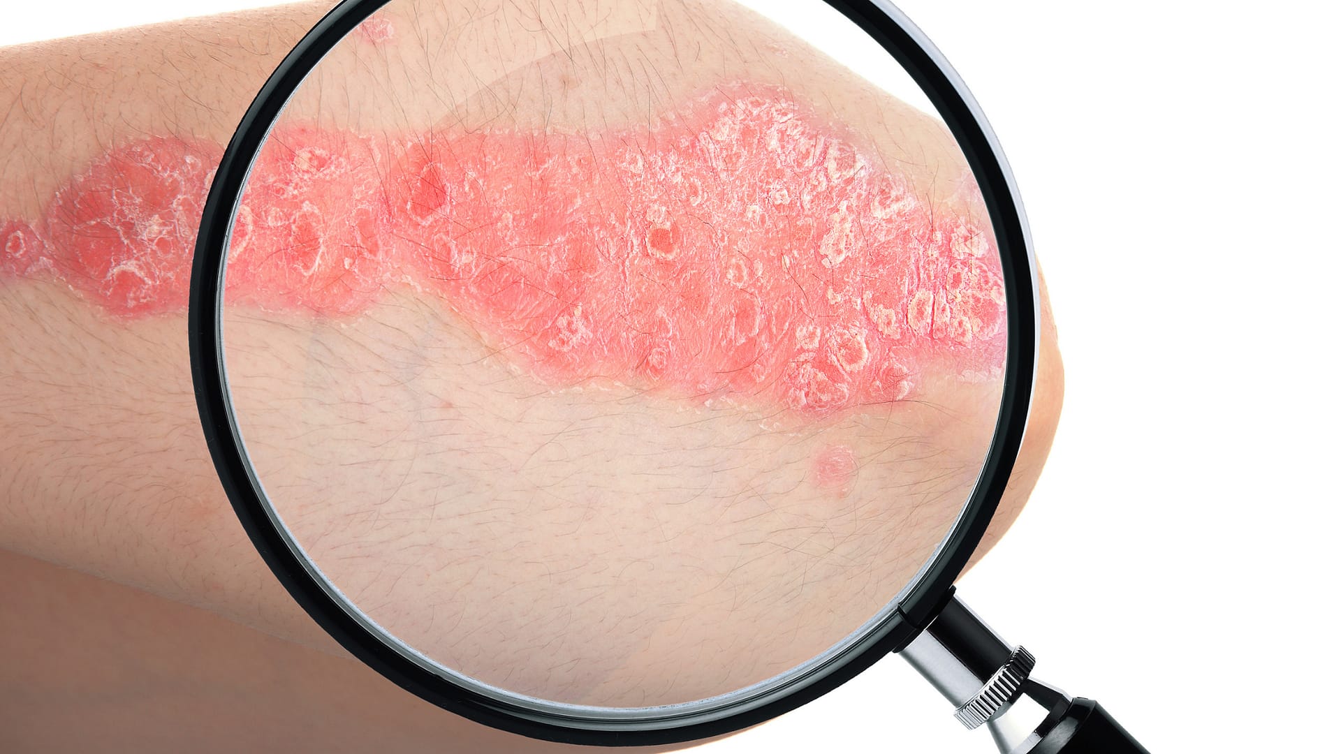 CBD na inne problemy skórne